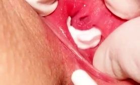 close-up-of-thorough-and-meticulous-pussy-examination